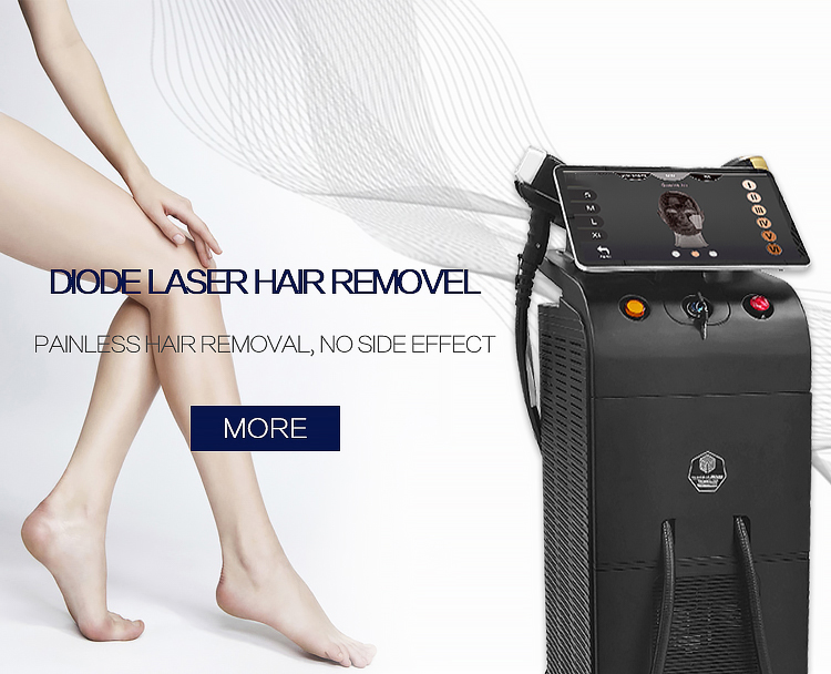 Диодный лазер для удаления волос с диодным лазером фабрики Super 755 808 1064