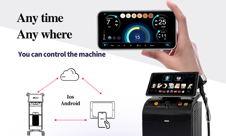 The world's latest 4k ultra-thin HD screen, customizable, with rental system, painless laser hair removal machine