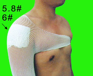 Hot Sale Different Size of Medical Tubular Net Bandage with High Elasticity
